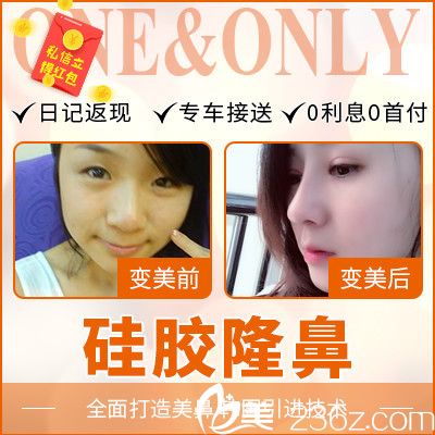 順德壹加壹瑪麗亞整容醫(yī)院肖鵬做的隆鼻<span style=