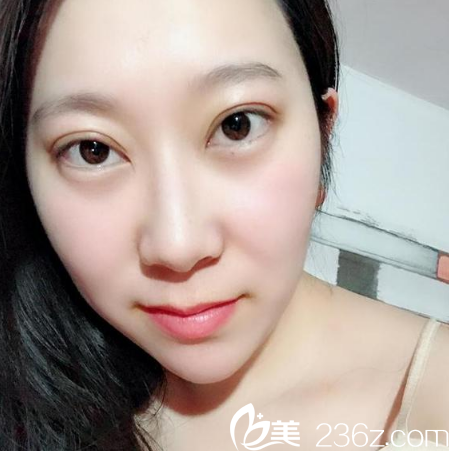 東莞做雙眼皮哪家醫(yī)院好 東莞做雙眼皮哪家醫(yī)院好