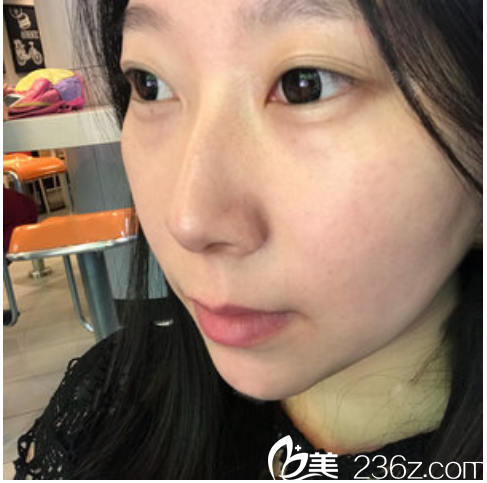 東莞南城西妃整形醫(yī)院做雙眼皮怎么樣 東莞南城西妃整形醫(yī)院做雙眼皮怎么樣