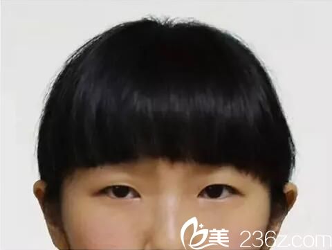 術(shù)前照片 術(shù)前照片