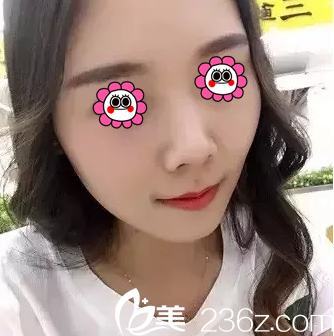 北京米蘭柏羽麗都注射案例