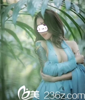 假體隆胸術(shù)后1個月胸部完全消腫 假體隆胸術(shù)后1個月胸部完全消腫