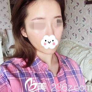 術后第三天 術后第三天