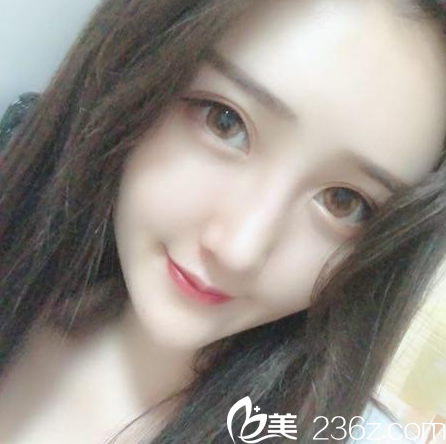 在廣州華美找鼻王曾高醫(yī)生做完鼻子后拿到一份隆鼻手術(shù)價格表