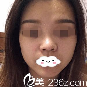 手術(shù)前的我 手術(shù)前的我