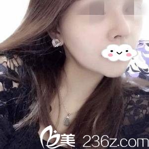 術(shù)后一周的效果 術(shù)后一周的效果