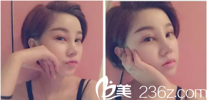 現(xiàn)在的眼睛還是依然的腫著