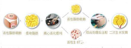  脂肪是怎么成活的呢？