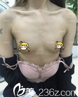 重慶軍科整形JK內(nèi)窺鏡全感豐胸術(shù)