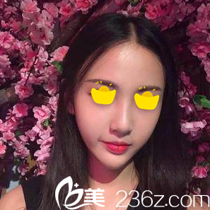 注射術(shù)后一周效果