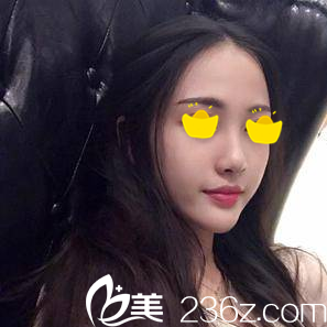 懷化整容醫(yī)院哪個(gè)好？分享我在懷化華美整形醫(yī)院注射美膚30天變化效果圖