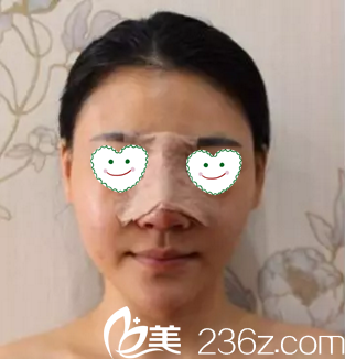 鼻綜合術后第2天<span style=