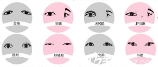 韓式雙眼皮優(yōu)勢(shì)