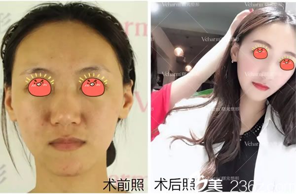 曙光明星臉真人案例效果圖