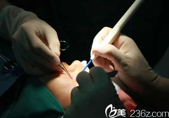 眼綜合整形手術(shù)中 眼綜合整形手術(shù)中