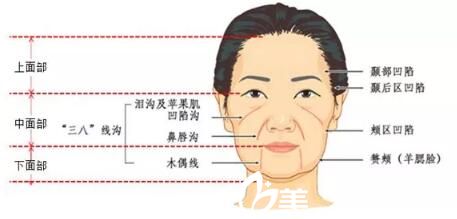 25+歲的女人面部開始出現(xiàn)的各種問題