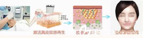 第四代黃金熱瑪吉雙倍熱能，拉得更緊