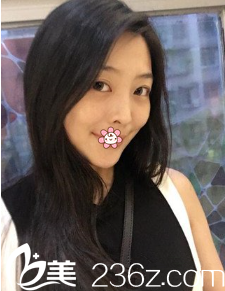 貴陽美萊做面部吸脂怎么樣