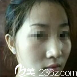 術(shù)前照片 術(shù)前照片