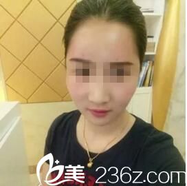 術(shù)后五天恢復(fù)效果 術(shù)后五天恢復(fù)效果