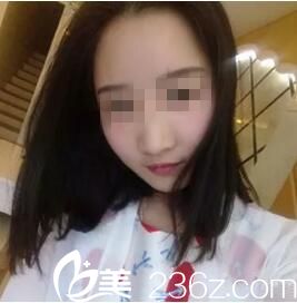 術(shù)后半個月恢復(fù)效果 術(shù)后半個月恢復(fù)效果