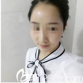 術(shù)后一個月恢復(fù)效果 術(shù)后一個月恢復(fù)效果