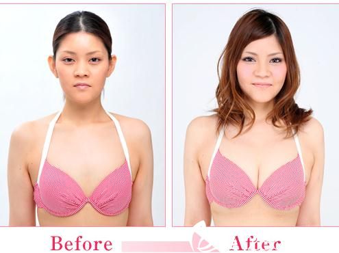 豐胸.jpg