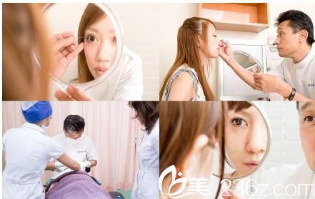 院長(zhǎng)親自操作的埋線雙眼皮