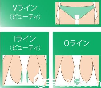 20181105_1541387540699707.jpg VIO.jpg