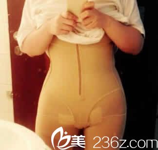 我在<!--<i data=20240703-sp></i>-->整形做360水動力吸脂后第3天照片 我在<!--<i data=20240703-sp></i>-->整形做360水動力吸脂后第3天照片