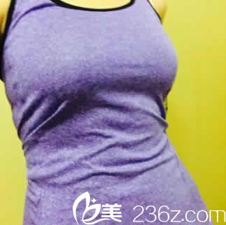  公開我在整形醫(yī)生做360水動力腰腹部環(huán)吸20天恢復(fù)效果圖及親身經(jīng)歷