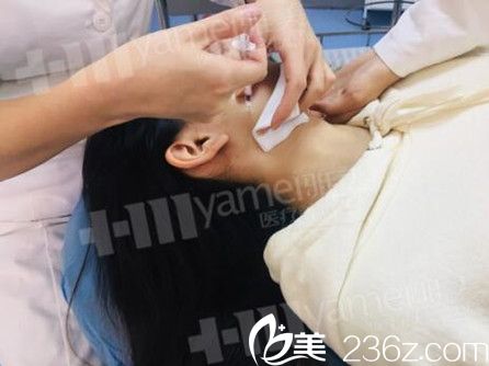 長沙雅美袁妍妍院長注射瘦臉中