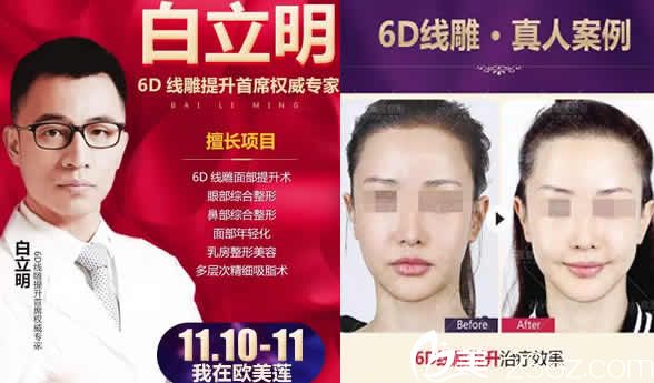 太原歐美蓮整形白立明醫(yī)生及面部線雕案例圖