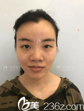 手術(shù)前的我 手術(shù)前的我