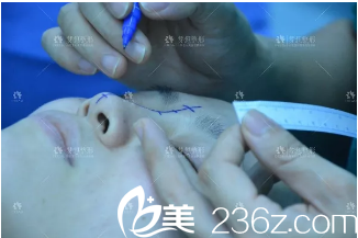 胡凱博士給我設(shè)計(jì)方案中 胡凱博士給我設(shè)計(jì)方案中