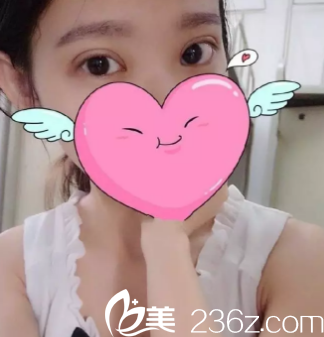 術(shù)后15天的樣子