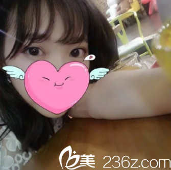 寶雞韓美做全切雙眼皮手術(shù)挺厲害的，通過案例來看技術(shù)確實不錯