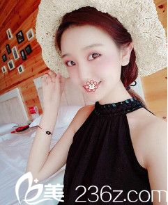 <!--<i data=20240703-sp></i>-->美萊自體脂肪全臉填充術(shù)后半個(gè)月