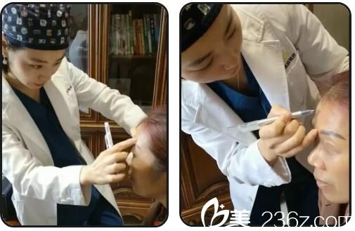 瘦臉除皺注射動(dòng)態(tài)皺紋過程中