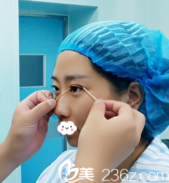 <i data-id='0fc1f97a-7e81-4446-b20d-c7f56a37e144' style='display:none;'></i>整形科王埴鋮雙眼皮效果怎么樣