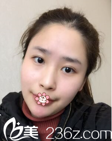 劉德東院長(zhǎng)給我做完手術(shù)后第8天 劉德東院長(zhǎng)給我做完手術(shù)后第8天