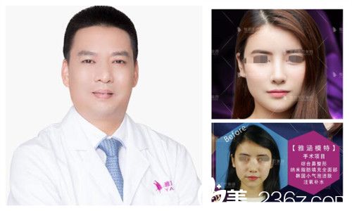 深圳雅涵整形醫(yī)院夏陽微整形案例 深圳雅涵整形醫(yī)院夏陽微整形案例