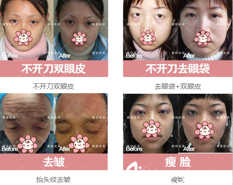 成都健麗雙眼皮去眼袋<span style= 成都健麗雙眼皮去眼袋<span style=