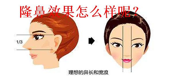 隆鼻效果怎么樣