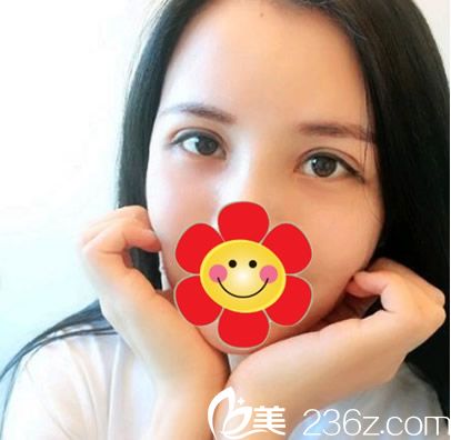 超聲波去眼袋半個月效果 超聲波去眼袋半個月效果