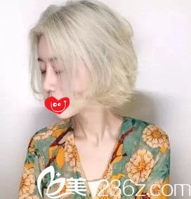 假體隆鼻2個(gè)月鼻子完全消腫 假體隆鼻2個(gè)月鼻子完全消腫