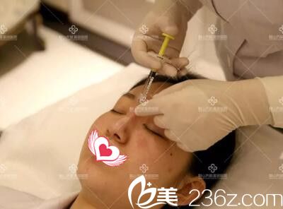 玻尿酸隆鼻手術過程中 玻尿酸隆鼻手術過程中