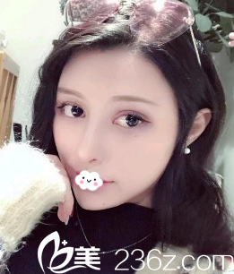 <!--<i data=20240703-sp></i>-->陳茂年假體隆鼻綜合整形<span style=