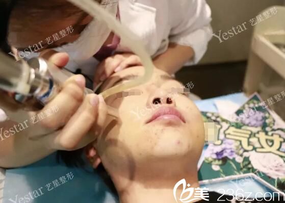 點(diǎn)陣激光祛痘過(guò)程中