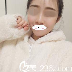 術(shù)后一周的效果 術(shù)后一周的效果